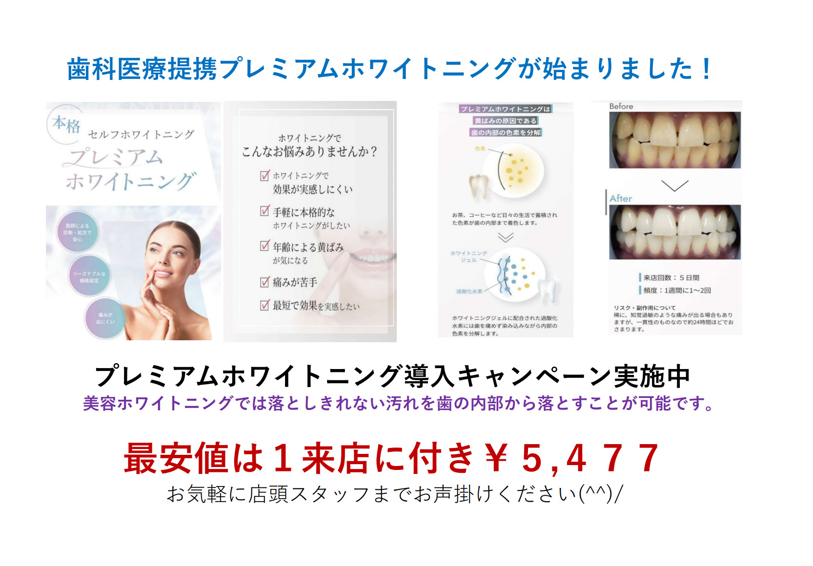 【医療提携】ホワイトニングメニュー導入　単品可 医療提携】ホワイトニングメニュー導入単品可