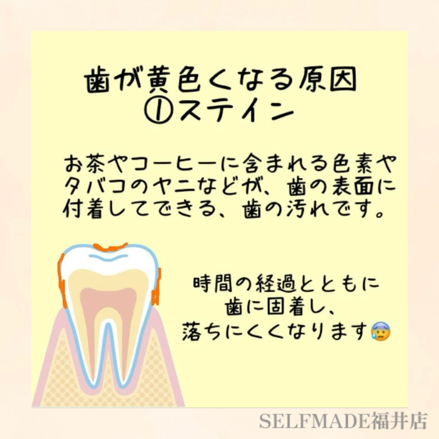 【福井店blog】歯が黄色くなる原因 | SELFMADE 福井店