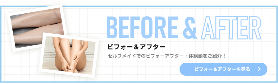 セルフメイドでのビフォーアフター・体験談をご紹介！