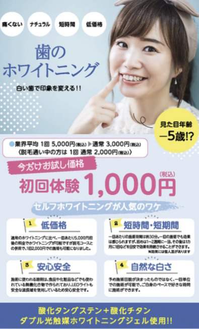 セルフホワイトニング始めました♪【都度払いで業界最安値 
